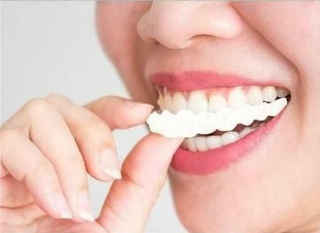 š„HOT SALEļ¼ā° Magic Smile Teeth Brace